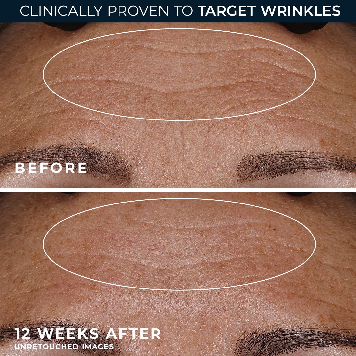 RETINOL CORREXION Deep Wrinkle Night Cream de Roc