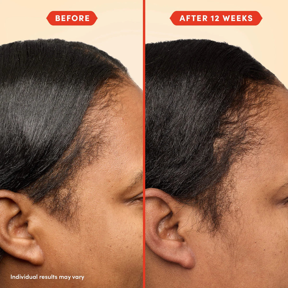 Fable & Mane HoliRoots™ Pre-Wash Scalp & Hair Treatment Oil