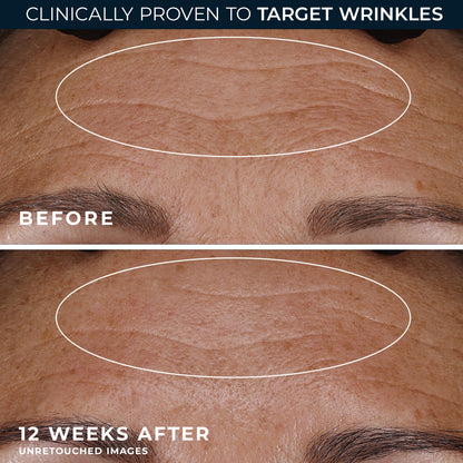 RETINOL CORREXION Deep Wrinkle Night Cream de Roc