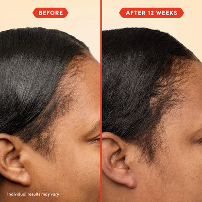 Fable & Mane HoliRoots™ Pre-Wash Scalp & Hair Treatment Oil