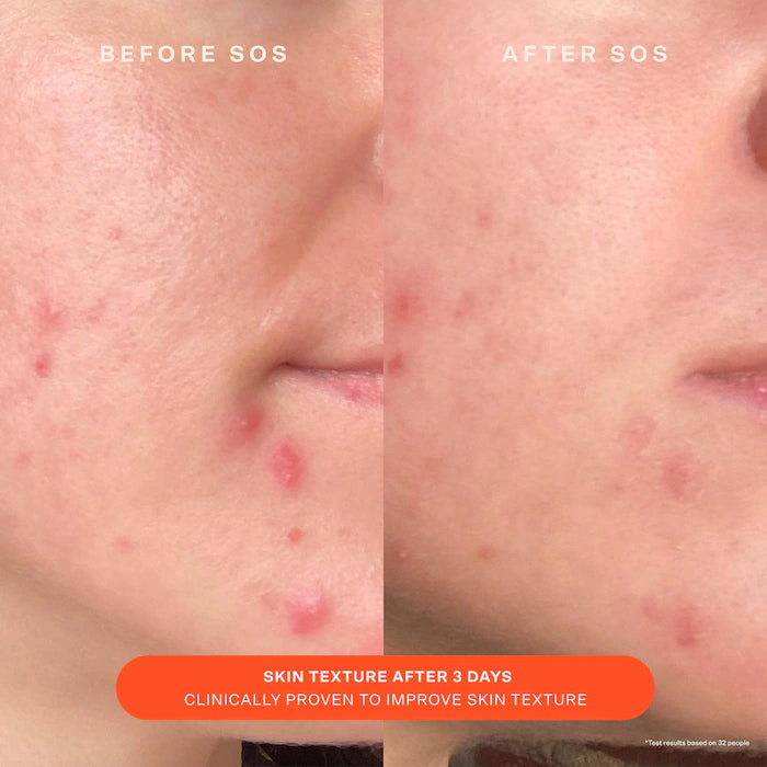 crema hidratante SOS Daily Skin Barrier Redness Recovery  de Tower 28